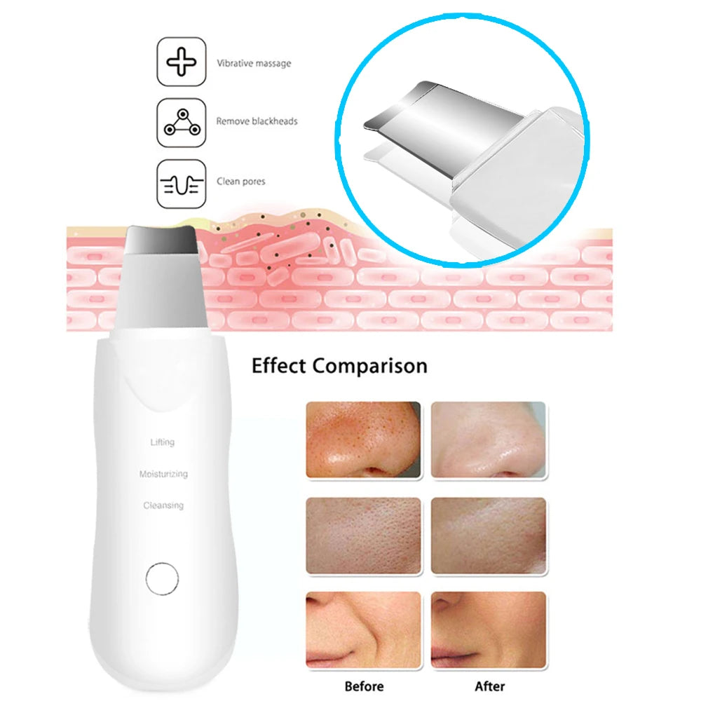Ultrasonic Skin Scrubber Scrubber